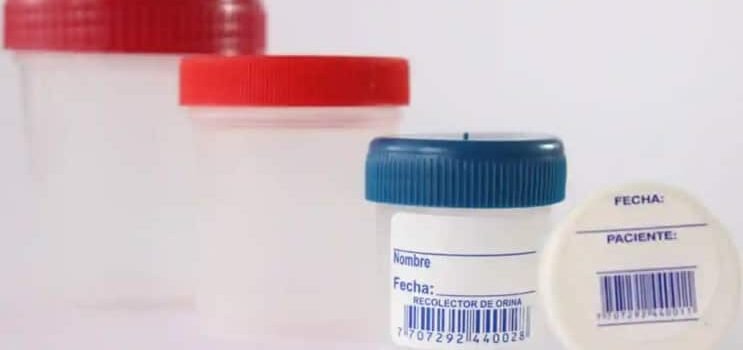 Gánate una lanita extra… vendiendo tus heces